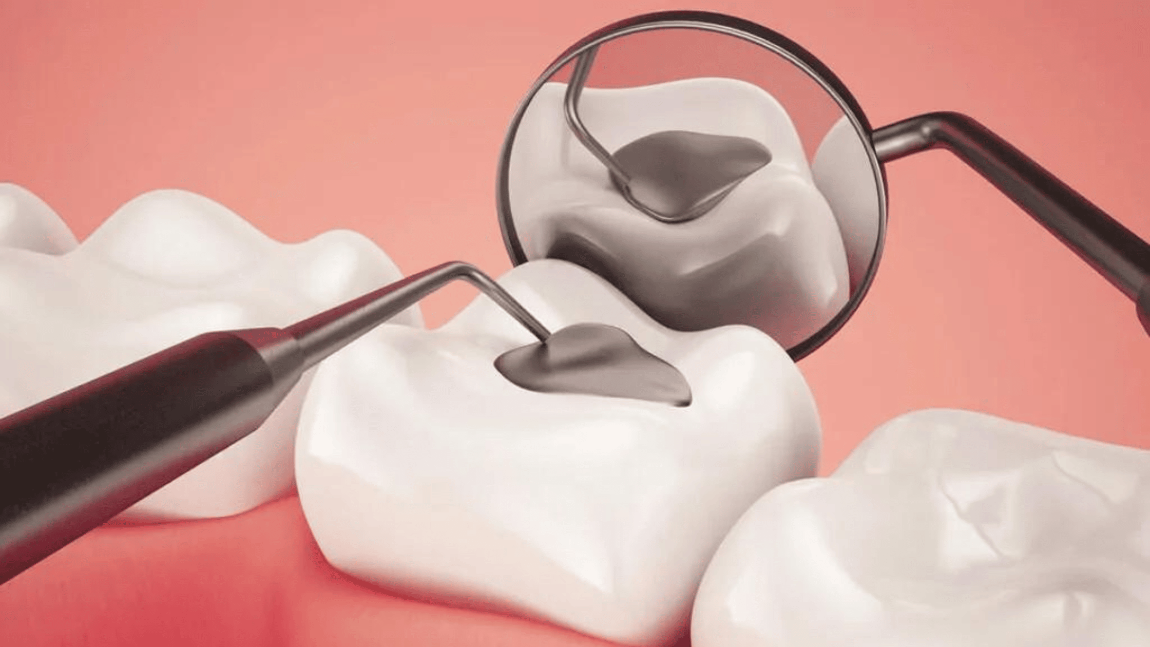 Featured image for “5 Simple Habits can Keep Away from Cavity”